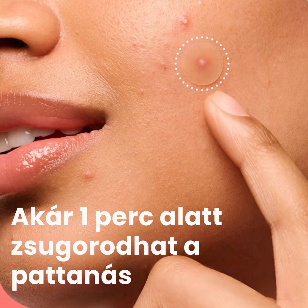 Avelisse Hidrokolloid Pattanás Elleni Tapasz